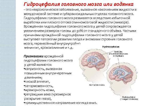 Симптомы водянки головного мозга