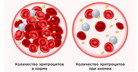 Симптомы вторичной анемии: как ее распознать?