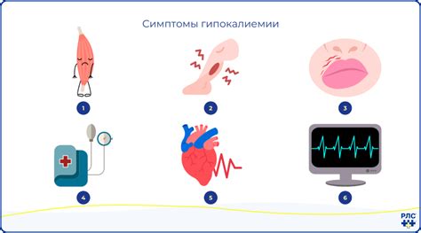 Симптомы гипокалиемии