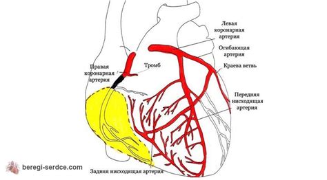 Симптомы гипокинеза задней стенки левого желудочка