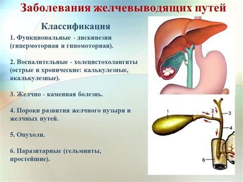 Симптомы гипофункции желчного пузыря