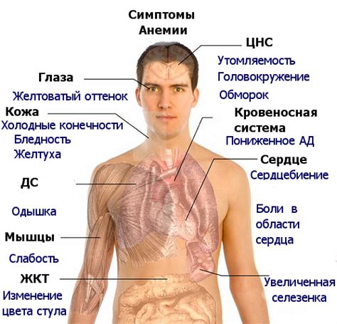 Симптомы гипохромной анемии