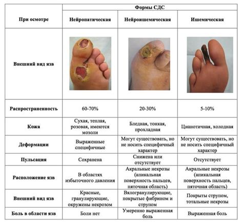 Симптомы гниения стопы при диабете