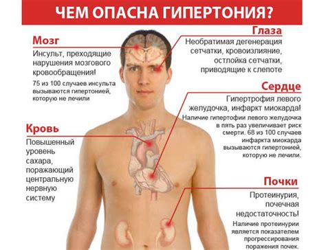 Симптомы головокружения при гипертонии