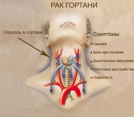 Симптомы горла красного и температуры у взрослых