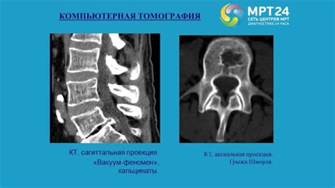 Симптомы дегенеративно-дистрофических изменений