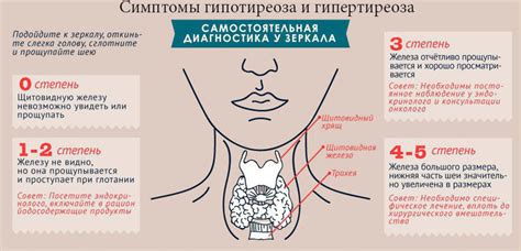 Симптомы и диагностика гипертиреоза