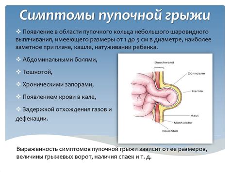 Симптомы и диагностика грыжи живота