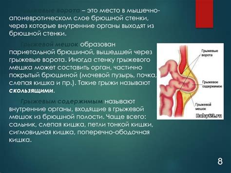 Симптомы и клиническая картина грыжи пупочной