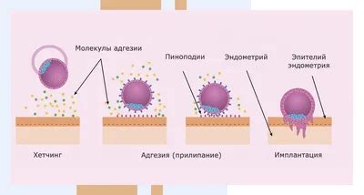 Симптомы и признаки ХГЧ 426