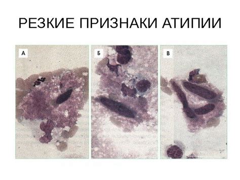 Симптомы и признаки атипии