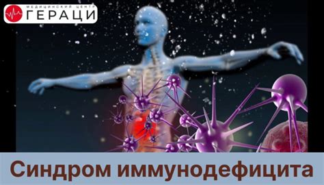 Симптомы и признаки иммунодефицита