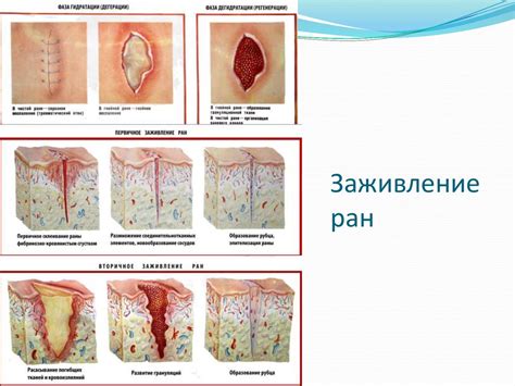 Симптомы и признаки наличия гнойной раны в области нижних конечностей