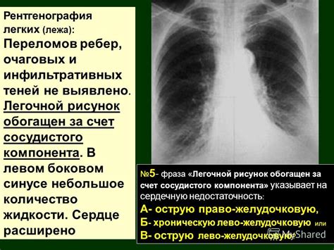 Симптомы и признаки отсутствия очаговых инфильтративных теней