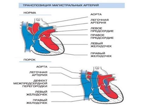 Симптомы и признаки расширения магистральных сосудов сердца