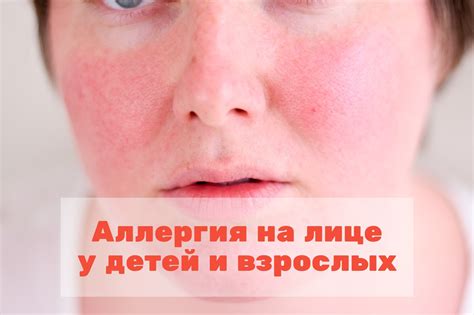 Симптомы и причины аллергии на лице