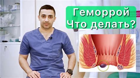 Симптомы и причины геморроя