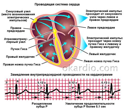 Симптомы и проявления нарушений внутрипредсердной проводимости