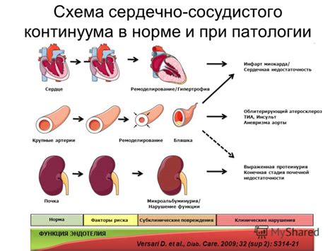 Симптомы концентрического ремоделирования левого желудочка сердца