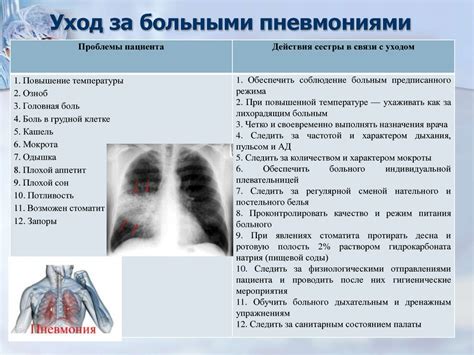 Симптомы матовости легких