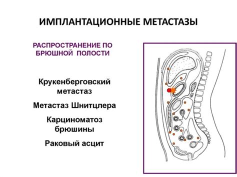 Симптомы наличия вторичных метастазов