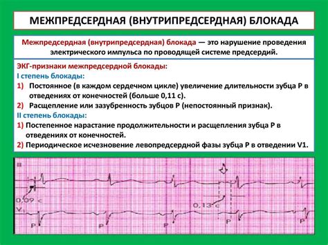 Симптомы нарушения атриовентрикулярной проводимости: