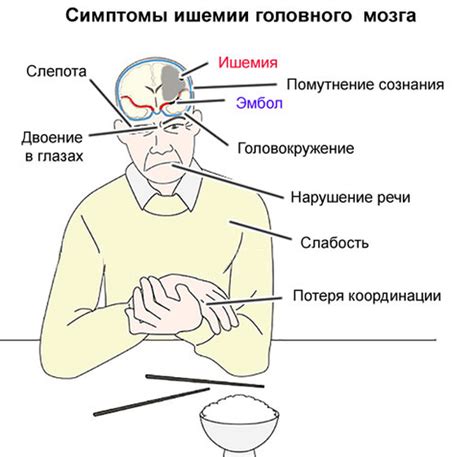 Симптомы неврологической ишемии