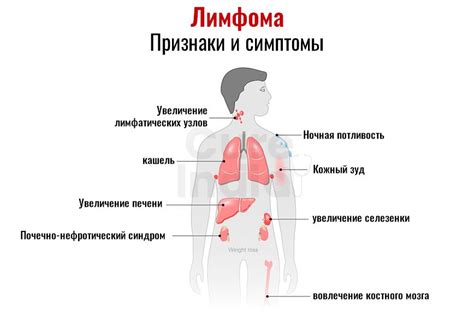 Симптомы неопластического поражения