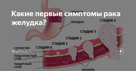 Симптомы неправильного функционирования желудка