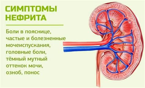 Симптомы нефрита