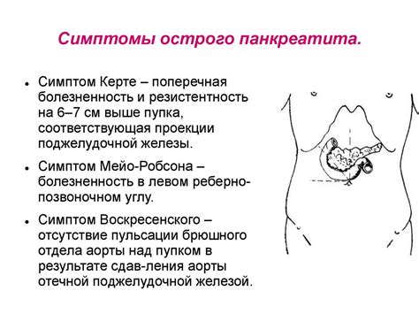 Симптомы острого билиарного панкреатита: как их распознать?