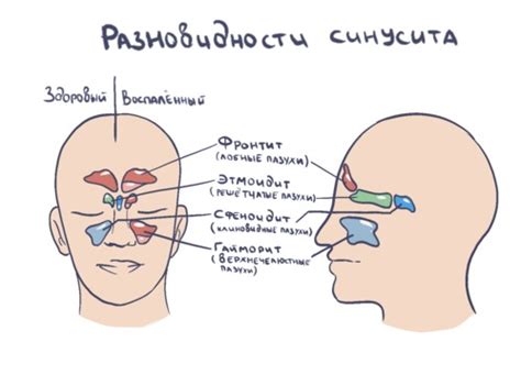 Симптомы отечности носа