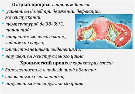 Симптомы подострого аднексита