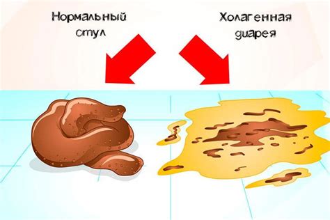 Симптомы поноса желчью