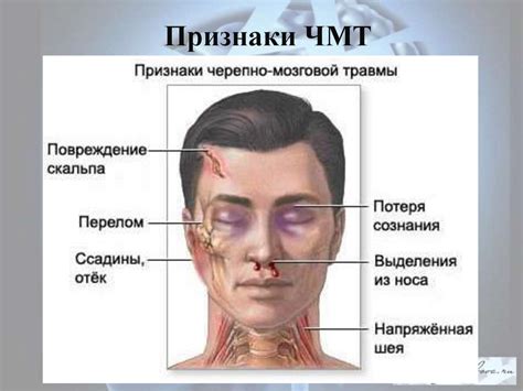 Симптомы слепого ранения головы: как их распознать?