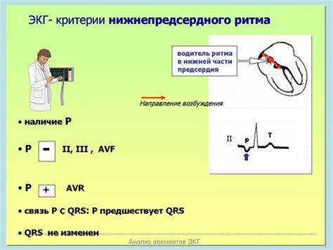 Симптомы среднеправопредсердного эктопического ритма