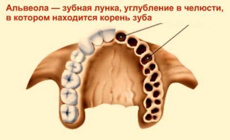 Симптомы сухой лузки после удаления зуба