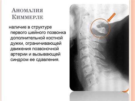 Симптомы талия аномалии