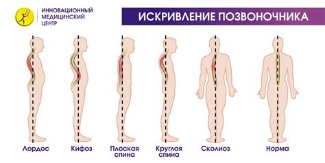 Симптомы тупой и острой боли