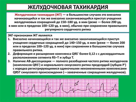 Симптомы укороченного сердечного ритма