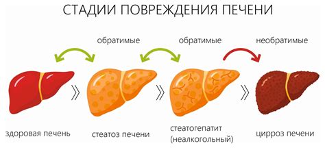 Симптомы цирроза печени стадии декомпенсации