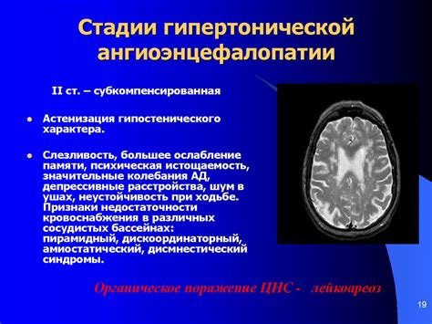 Симптомы энцефалопатии у ребенка 3 месяца