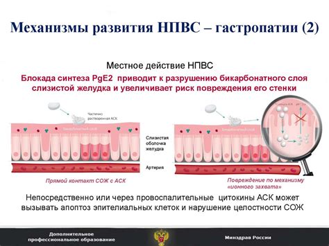 Симптомы эрозивно-язвенного поражения