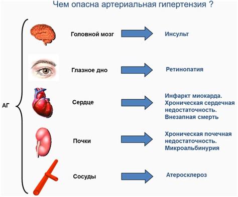 Симптомы эссенциальной артериальной гипертензии