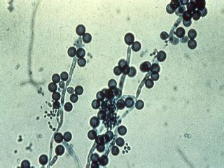 Симптомы Candida Albicans