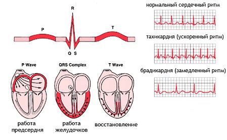 Синусовая дыхательная аритмия у детей 9 лет