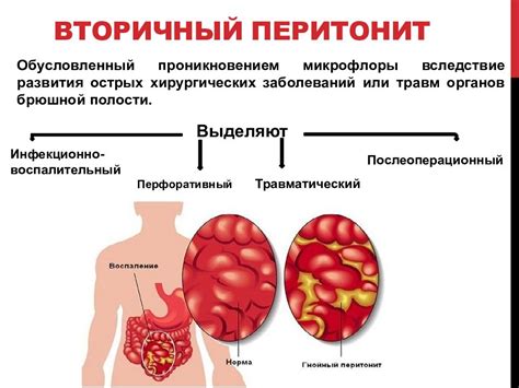 Системные заболевания, приводящие к кровавому кашлю