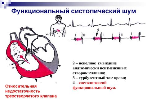 Систолический шум у ребенка: основные аспекты