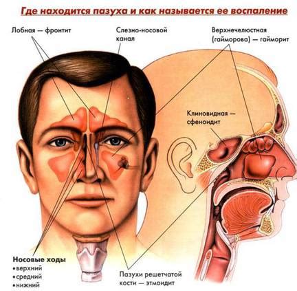 Сколиозный нос: определение и симптомы