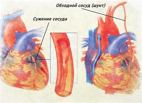 Сколько длится прерывистая линия сердца?